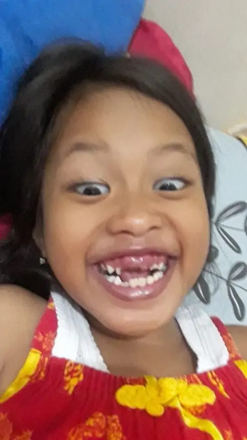 25 Ảnh gái xinh lỗi nhịp bắt trúng nụ cười rộng của bé mặc đồ đỏ vàng, mắt mở to và răng lộ rõ làm cả khuôn mặt bừng sáng, một kiểu ảnh chế hài hước rất hợp lưu giữ vì năng lượng vui lan ra khỏi khung
