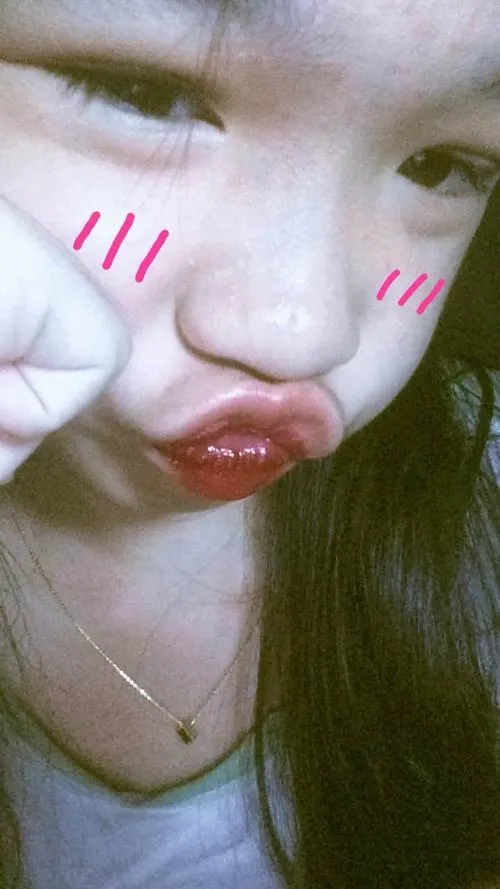 10 Duck face nhẹ nhàng trên gương mặt cô gái giúp đường nét nổi bật hơn mà vẫn giữ vẻ dễ thương